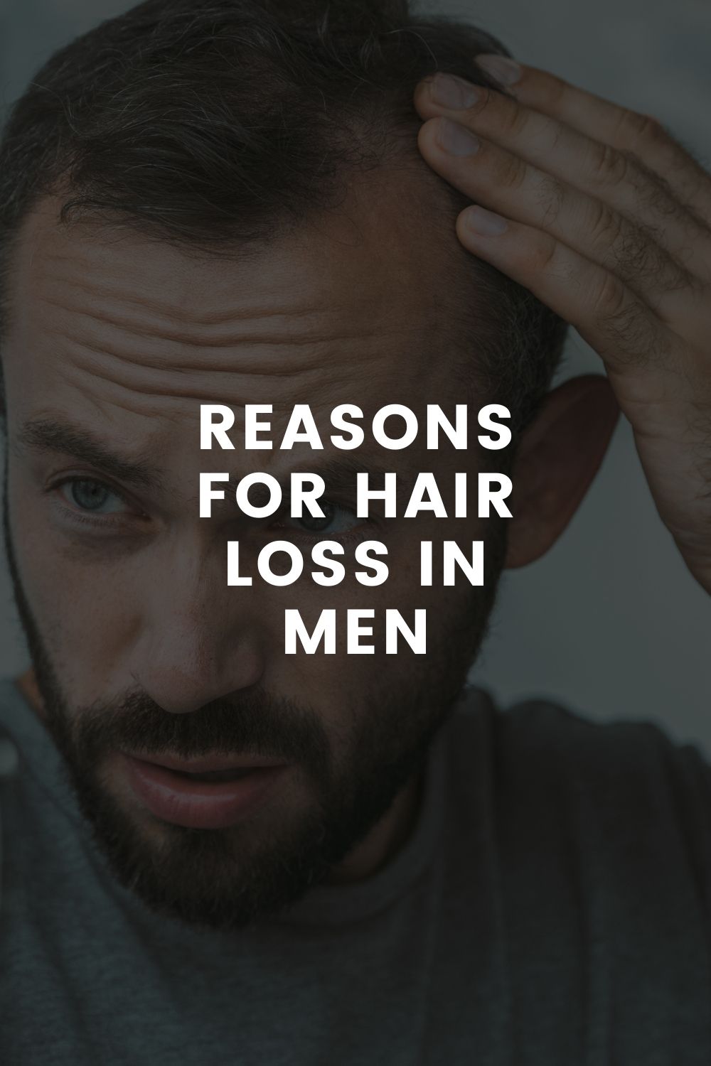 Reasons For Hair Loss in Men