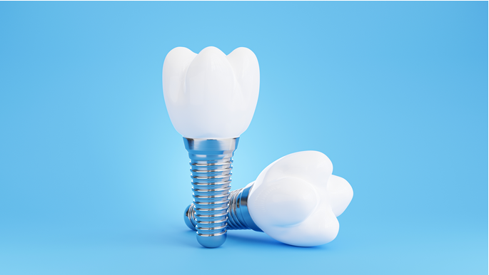 Dental Implants